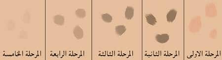 حروق الليزر للمنطقة الحساسة وأنواعها وطرق العلاج الصحيحة مميزة